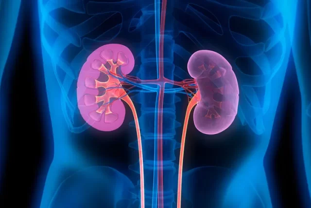 kidney failure kidney failure