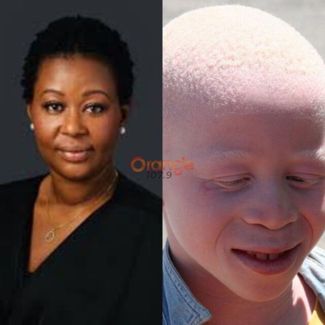 Ewuraben-Aubyyn-on persons living with albinism