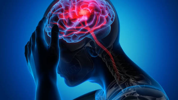 stroke Senior Physician Specialist at the 37 Military Hospital, has urged Ghanaians to adopt healthier diets to lower their risk of stroke