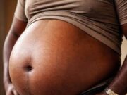 Why your potbelly is more than just a wardrobe issue. Treating a potbelly as a mere cosmetic nuisance signals a full-blown metabolic crisis unfolding deep inside your body.